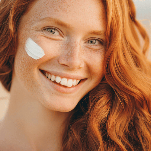 Pigmentflecken-was-tun-creme