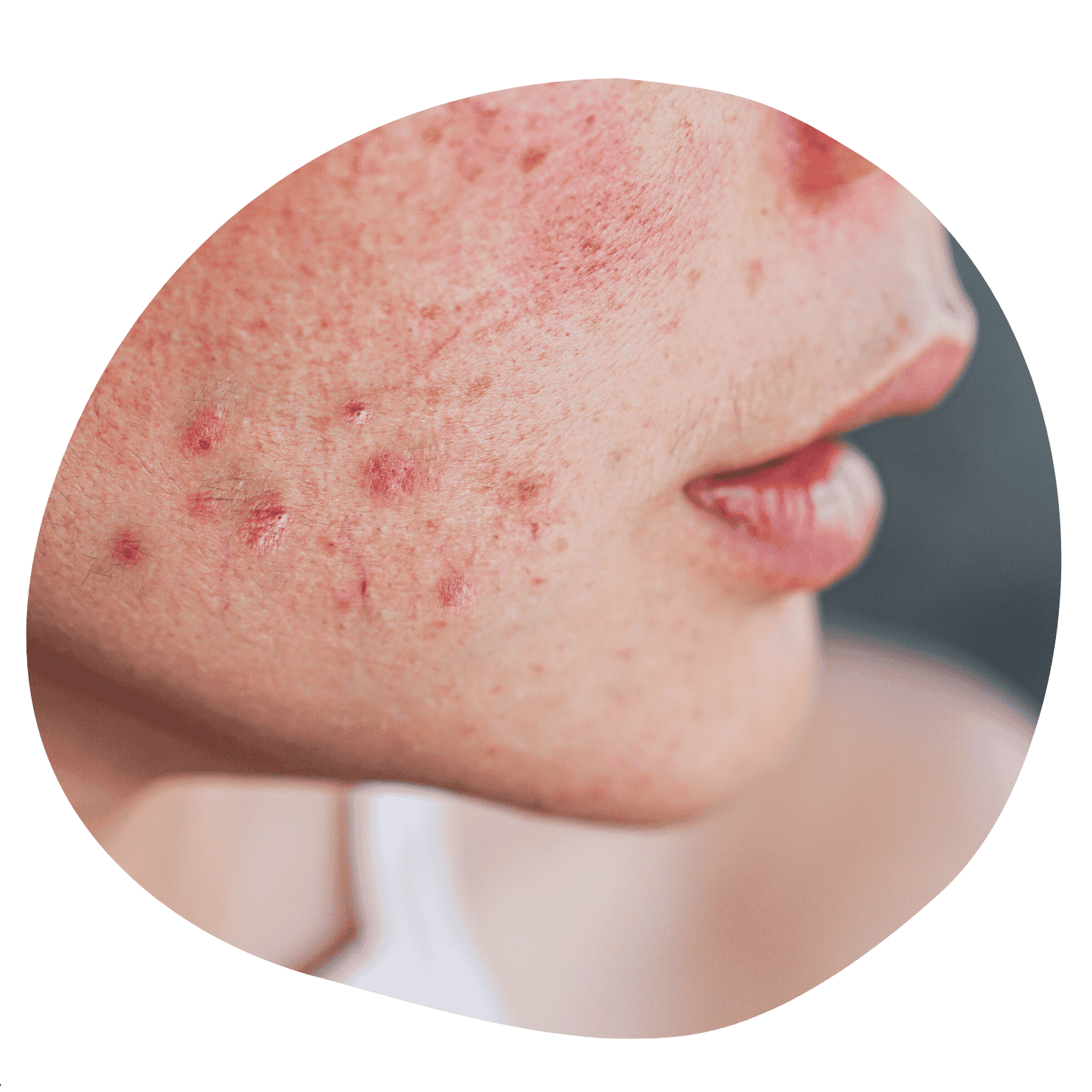 Puræsthetic Skincare-Mischhaut-Gesichtspflege